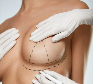 Tips For Dealing With Unmet Plastic Surgery Expectations