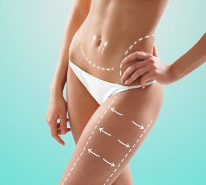 Does A Tummy Tuck Procedure Have Medical Benefits
